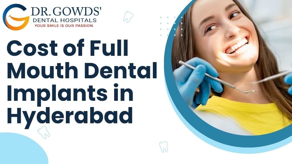 Cost of full mouth dental implants in hyderabad