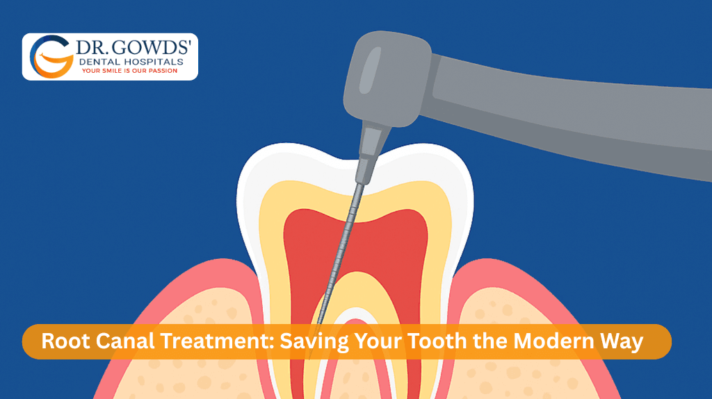 root canal treatment saving your tooth the modern way