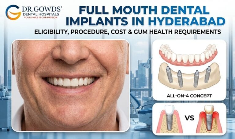 full mouth dental implants in hyderabad eligibility, procedure, cost & gum health requirements
