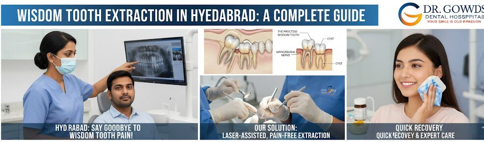 hyderabad's guide to stress free wisdom tooth removal what to do expect at dr. gowds dental