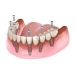 affordable cosmetic dental experts northampton.jpg