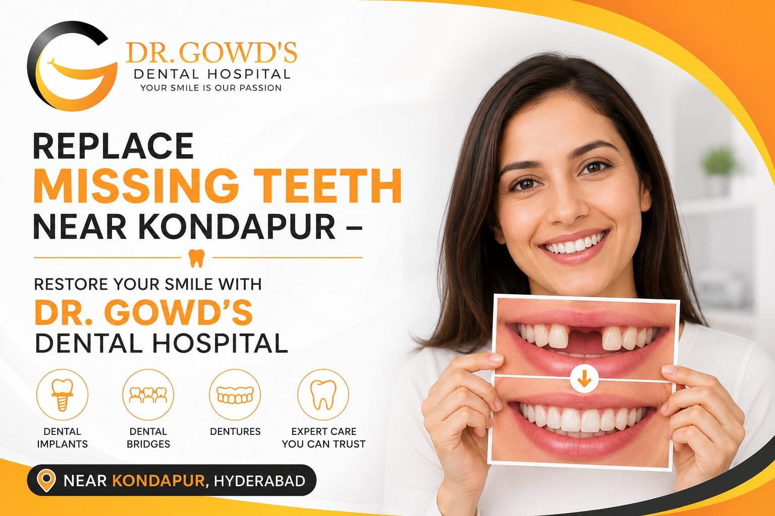 drgowdas missingteeth kondapur blog1 1