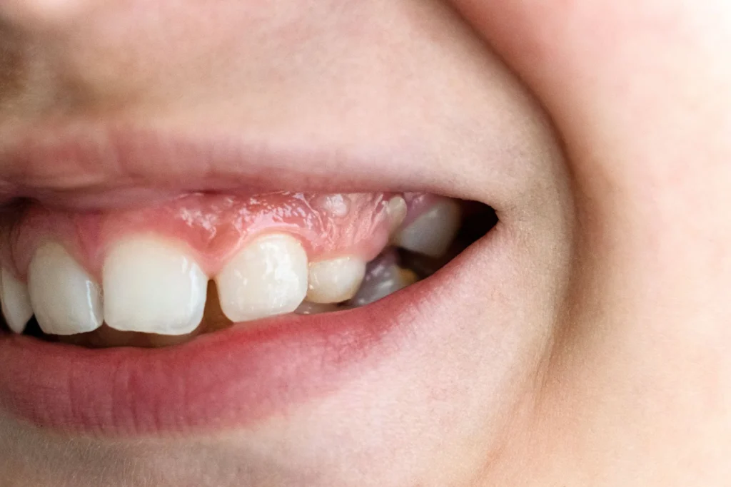 kids dentist teeth3 5