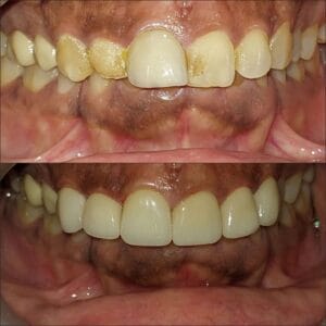 Dentist in Madhapur -Gowd's Dental Hospital whatsapp image 2026 06 18 at 1.14.39 pm