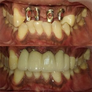 Dentist in Madhapur -Gowd's Dental Hospital whatsapp image 2026 07 25 at 10.00.57 am (2)