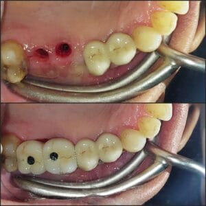Dentist in Madhapur -Gowd's Dental Hospital whatsapp image 2026 07 25 at 10.00.57 am