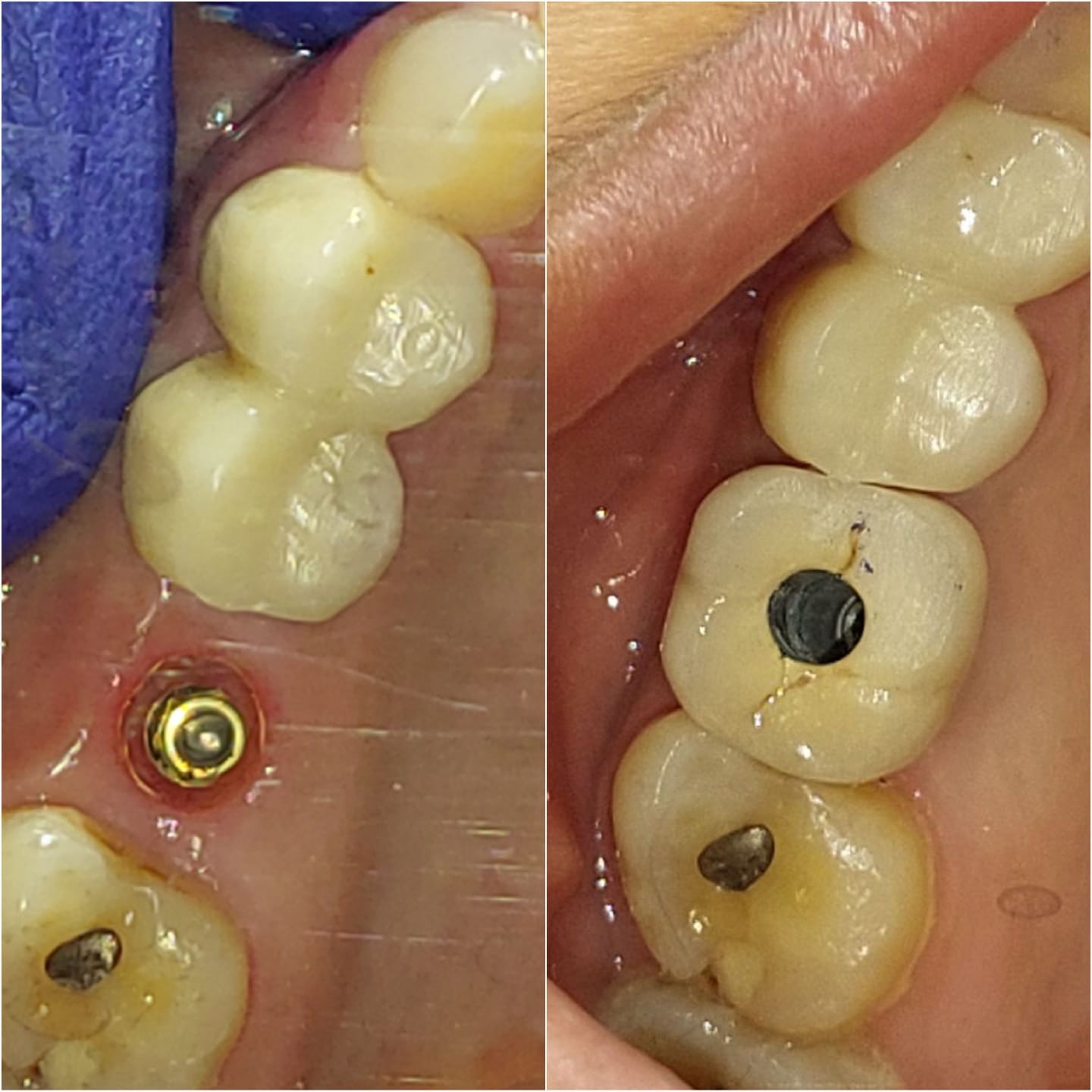 Dentist in Madhapur -Gowd's Dental Hospital whatsapp image 2026 07 25 at 10.00.58 am (1)