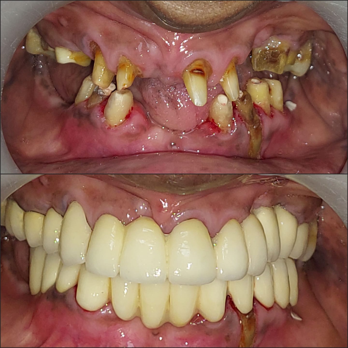 Dentist in Madhapur -Gowd's Dental Hospital whatsapp image 2026 07 25 at 10.00.58 am (2)