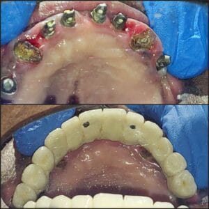 Dentist in Madhapur -Gowd's Dental Hospital whatsapp image 2026 07 25 at 10.00.59 am (1)