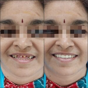 Dentist in Madhapur -Gowd's Dental Hospital whatsapp image 2026 07 25 at 10.00.59 am