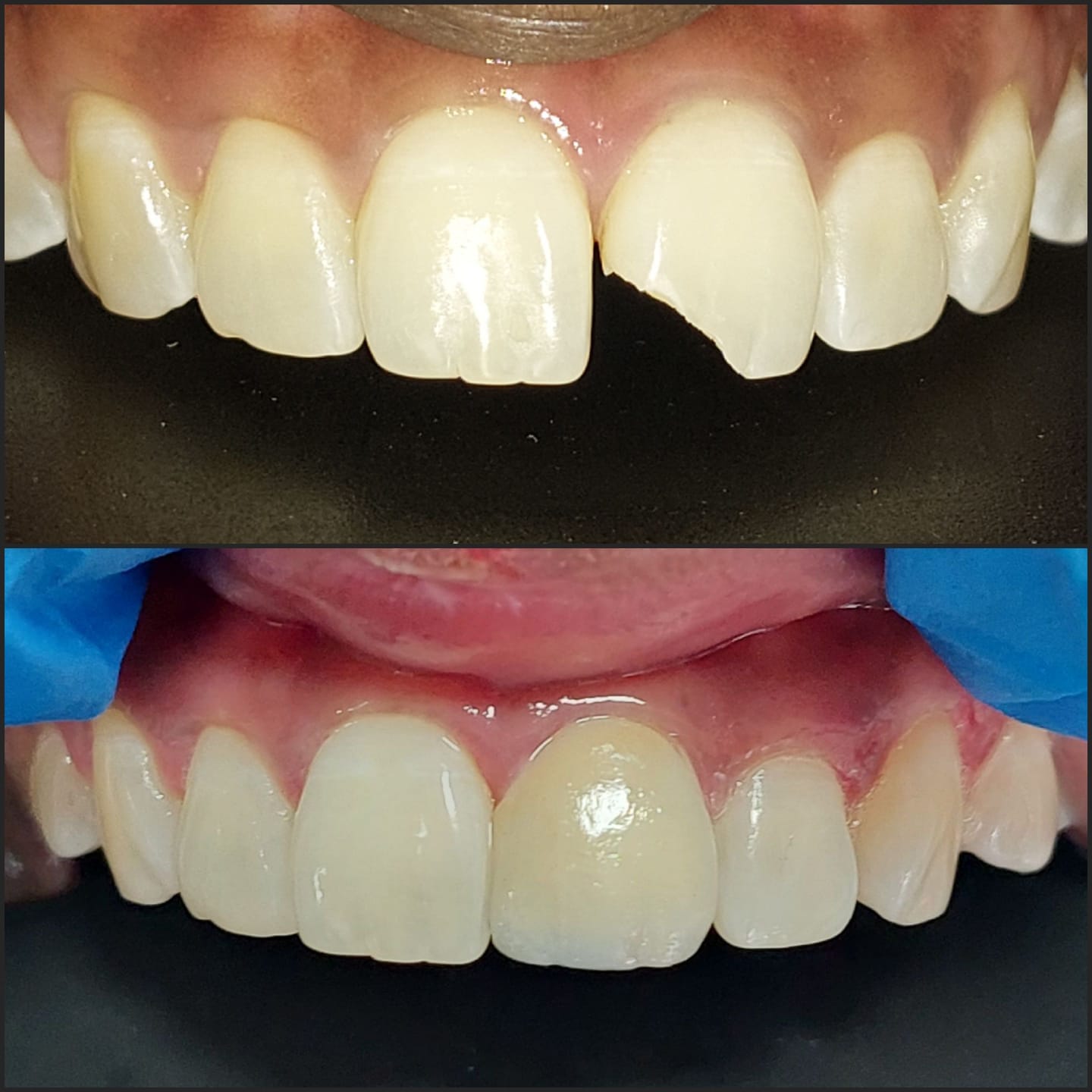 Dentist in Madhapur -Gowd's Dental Hospital whatsapp image 2026 07 25 at 10.01.00 am (3)