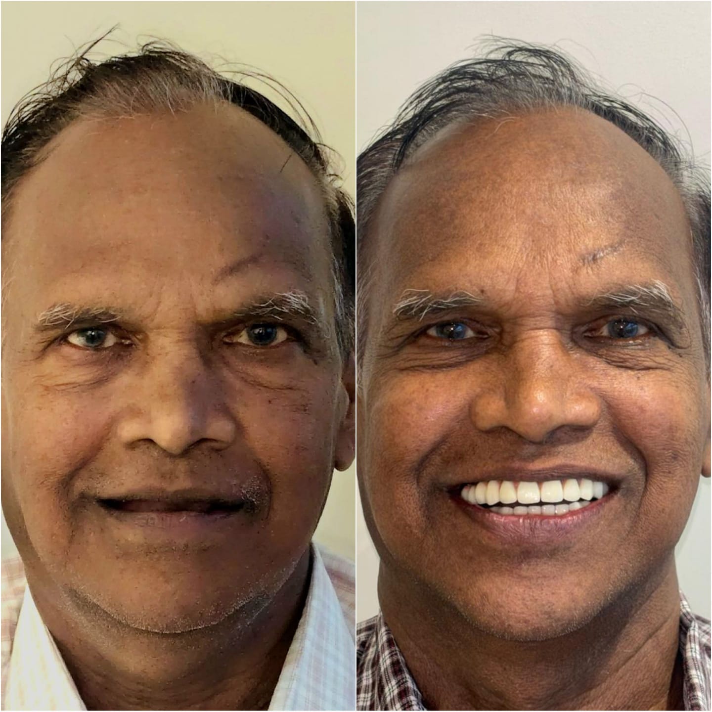 Dentist in Madhapur -Gowd's Dental Hospital whatsapp image 2026 07 25 at 10.01.03 am