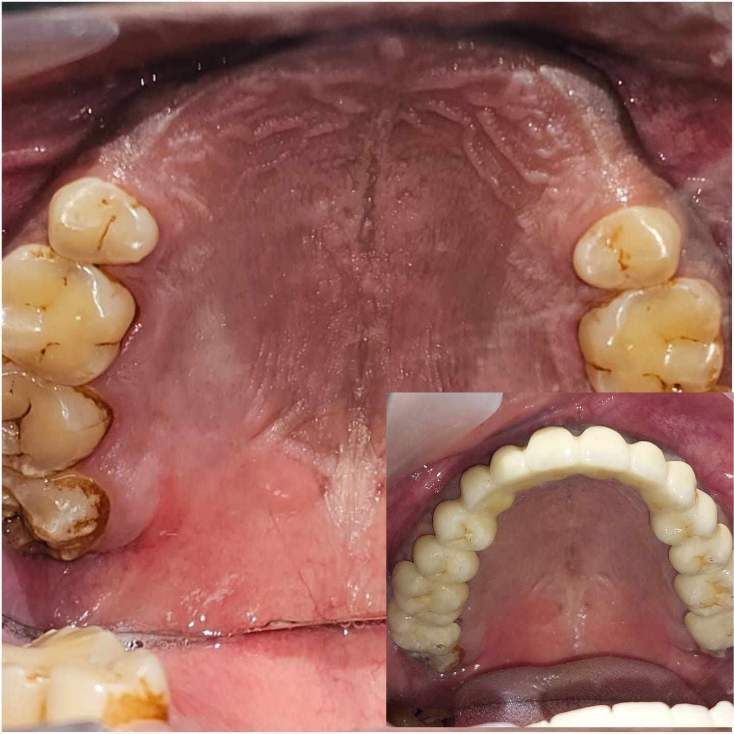 Dentist in Madhapur -Gowd's Dental Hospital whatsapp image 2026 07 25 at 10.01.04 am