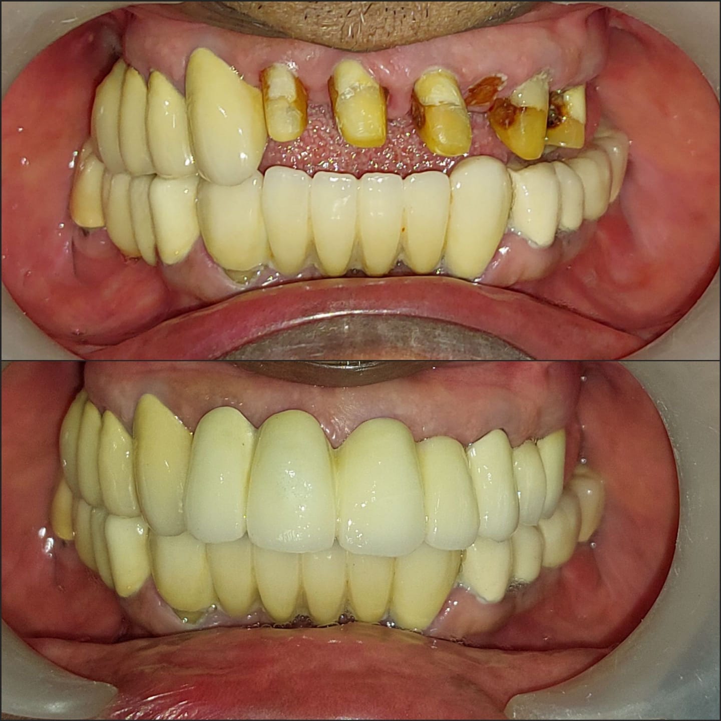 Dentist in Madhapur -Gowd's Dental Hospital whatsapp image 2026 07 25 at 10.01.05 am (1)