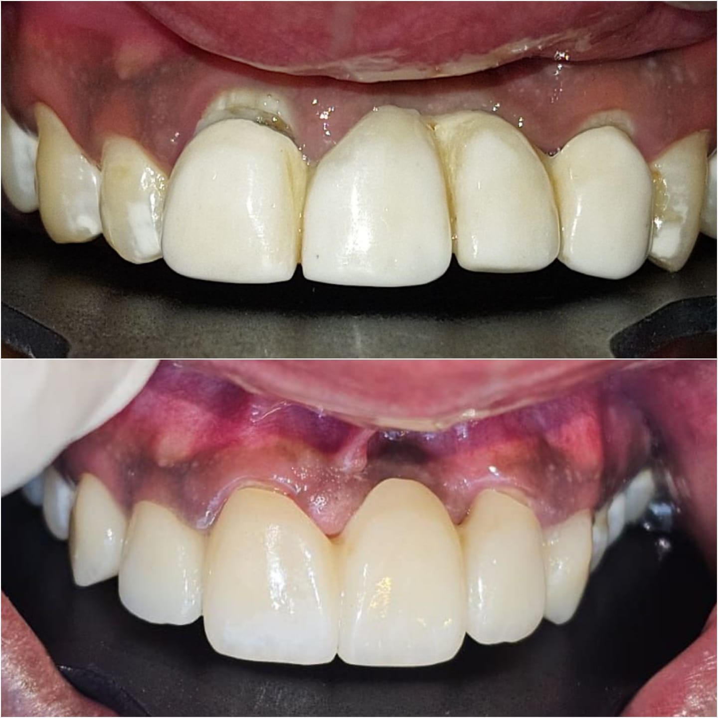 Dentist in Madhapur -Gowd's Dental Hospital whatsapp image 2026 07 25 at 10.01.05 am