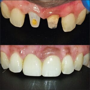 Dentist in Madhapur -Gowd's Dental Hospital whatsapp image 2026 07 25 at 10.01.06 am (1)