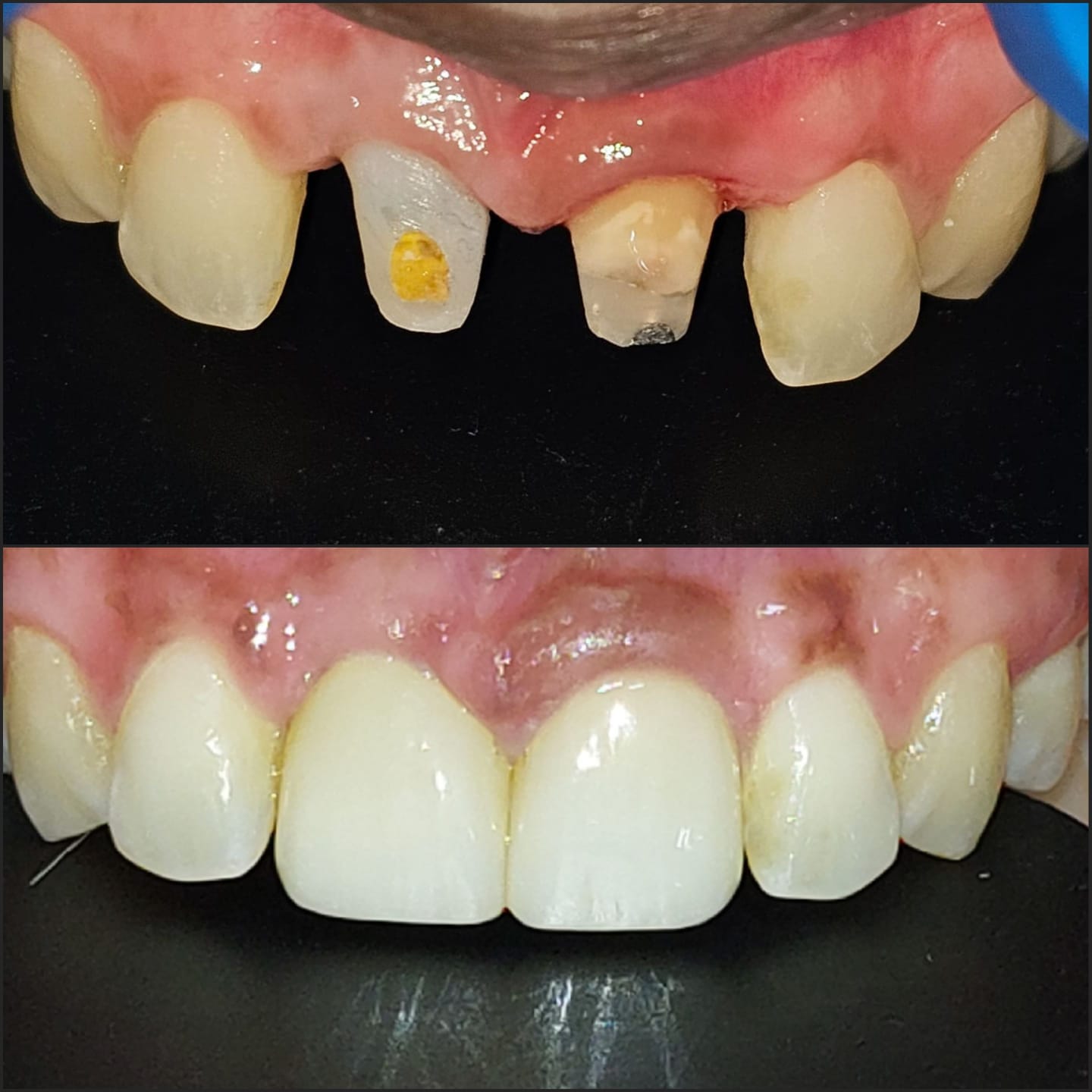 Dentist in Madhapur -Gowd's Dental Hospital whatsapp image 2026 07 25 at 10.01.06 am (1)