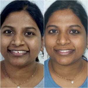 Dentist in Madhapur -Gowd's Dental Hospital whatsapp image 2026 07 25 at 10.01.07 am